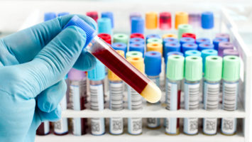 Diagnosing Cancer With A Simple Blood Test