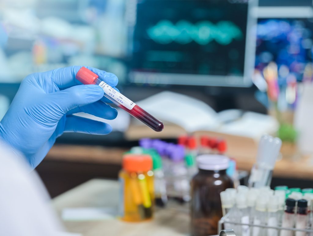 Centers for AIDS Research