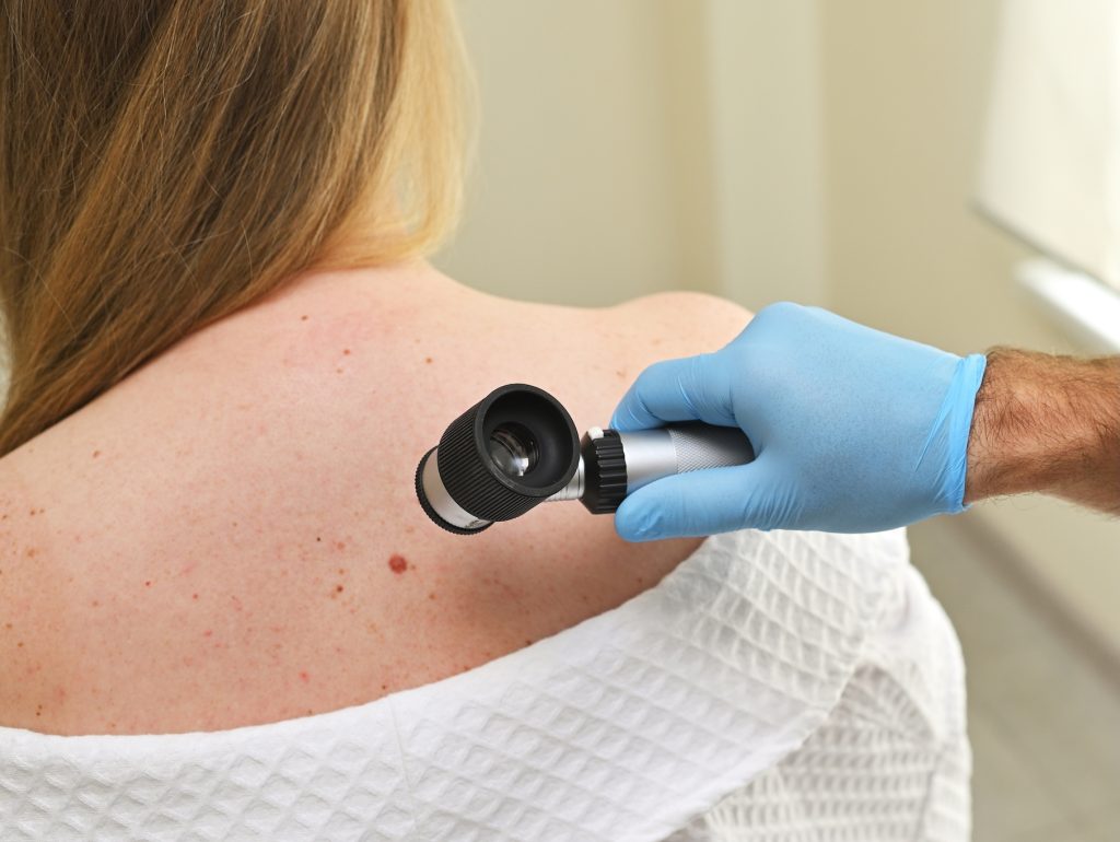 DoD Melanoma, Team Science Award