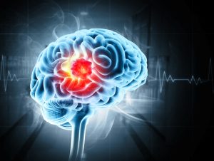 Assay Development and Screening for Discovery of Validated Chemical Hits for Brain Disorders