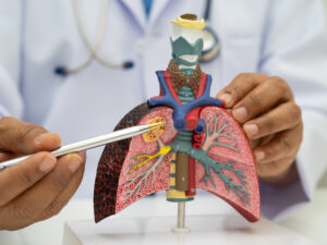 DoW Lung Cancer Idea Development Award