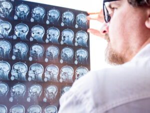 DoW Multiple Sclerosis Clinical Trial Award