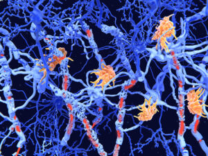 DoW Multiple Sclerosis Exploration-Hypothesis Development Award