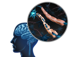 DoW Multiple Sclerosis Investigator-Initiated Research Award
