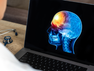 Traumatic Brain Injury Model Systems National Data and Statistical Center