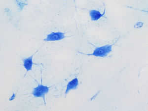 BRAIN Initiative: Clinical Studies to Advance Next-Generation Devices for Recording and Modulation in the Human Central Nervous System