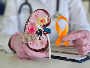 DoW Kidney Cancer, Idea Development Award